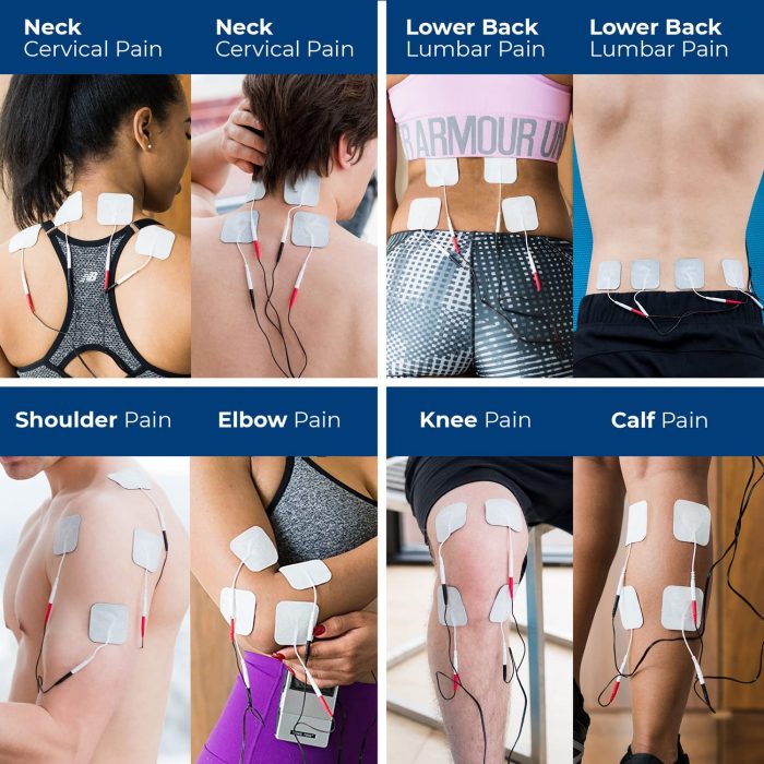 InTENSity 7 OTC TENS - Image 3